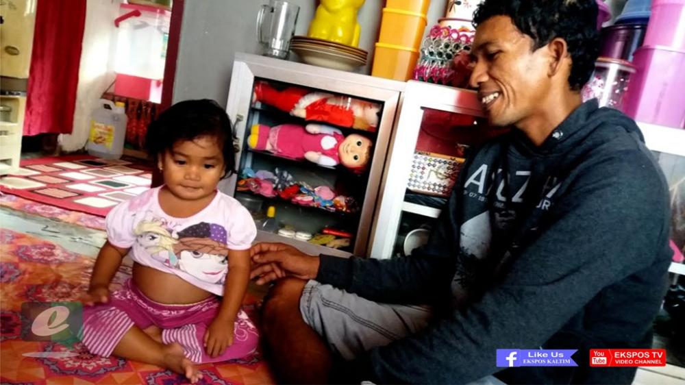 Bocah 6 Tahun Pengidap Tumor Ini Butuh Uluran Tangan Dermawan