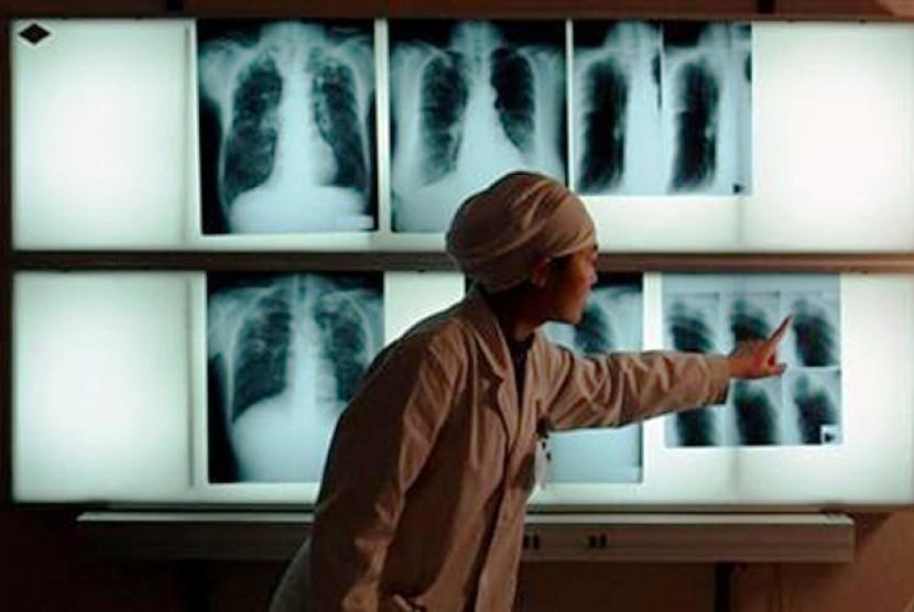 TB Mengintai Kaltim, Deteksi Dini Jadi Kunci 