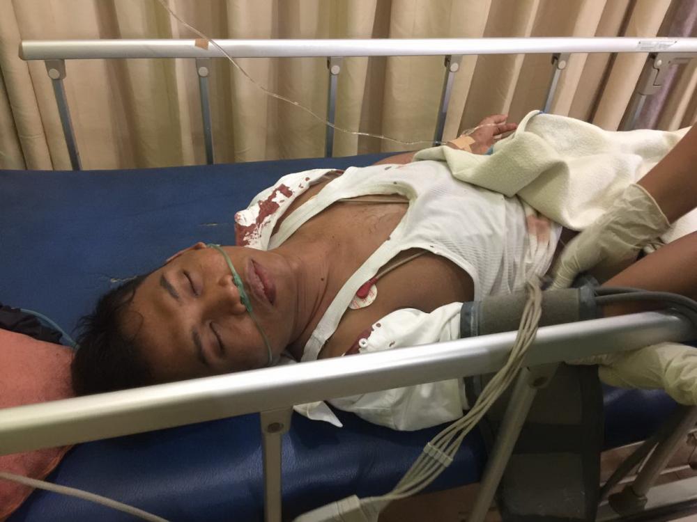 Supir Land Cruiser Nahas Ini Sempat Koma 