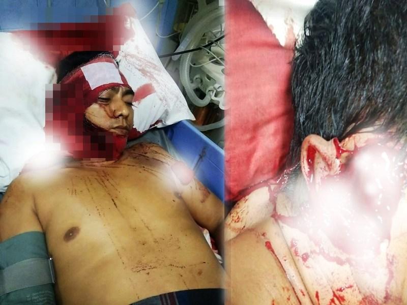 Sadis, Paman Potong Telinga Ponakan Hingga Putus saat Terlelap Tidur