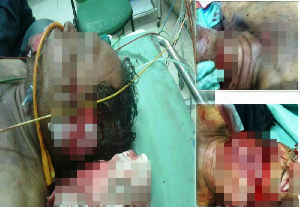 Istri Tukang Ojek Korban Bacok Pernah Bekerja di Rumah Kosim