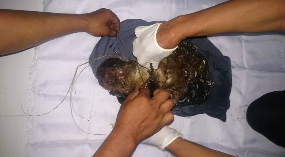 NAAS, BAYI  DITEMUKAN DALAM KEADAAN HANGUS TERBAKAR.