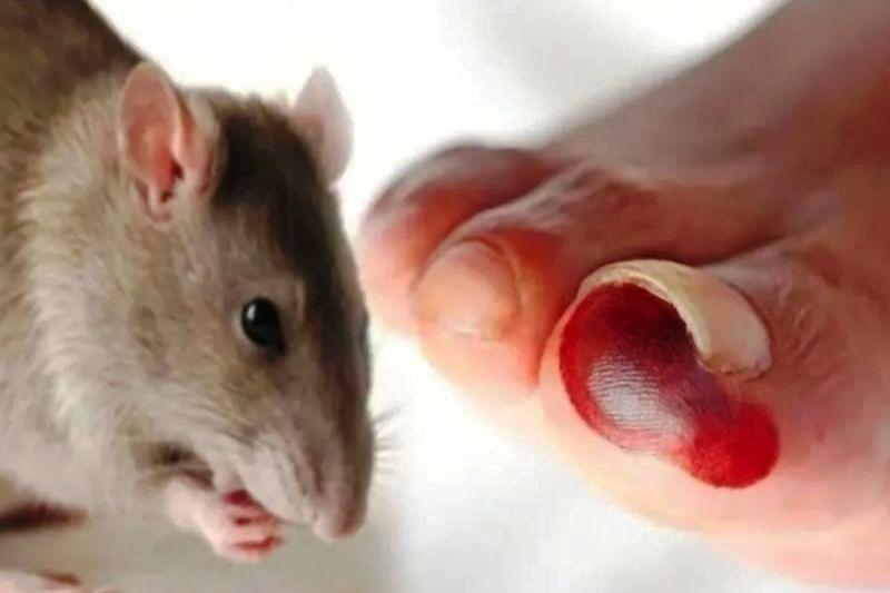 Bahaya Virus Hanta: Berawal dari Tikus, Berujung Gagal Napas 