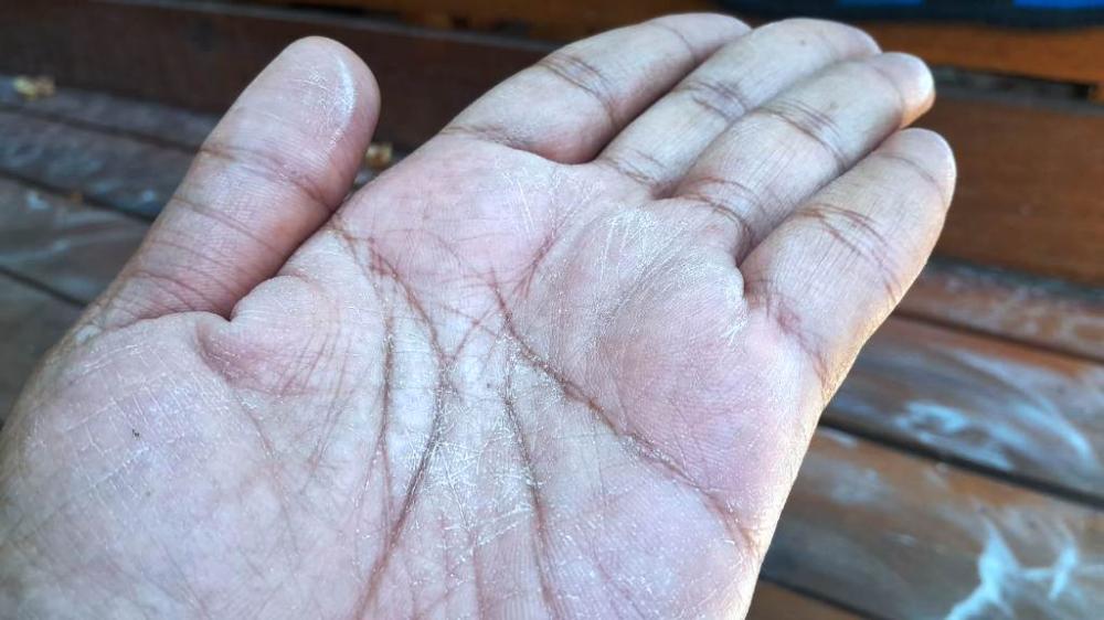 Hujan Debu di Balikpapan, Dinkes Kaltim Waspadai Lonjakan ISPA  
