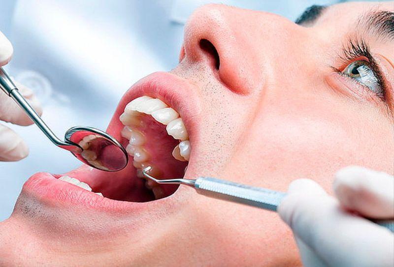 Cegah Kerusakan Gigi, Hindari Makanan dan Minuman Ini