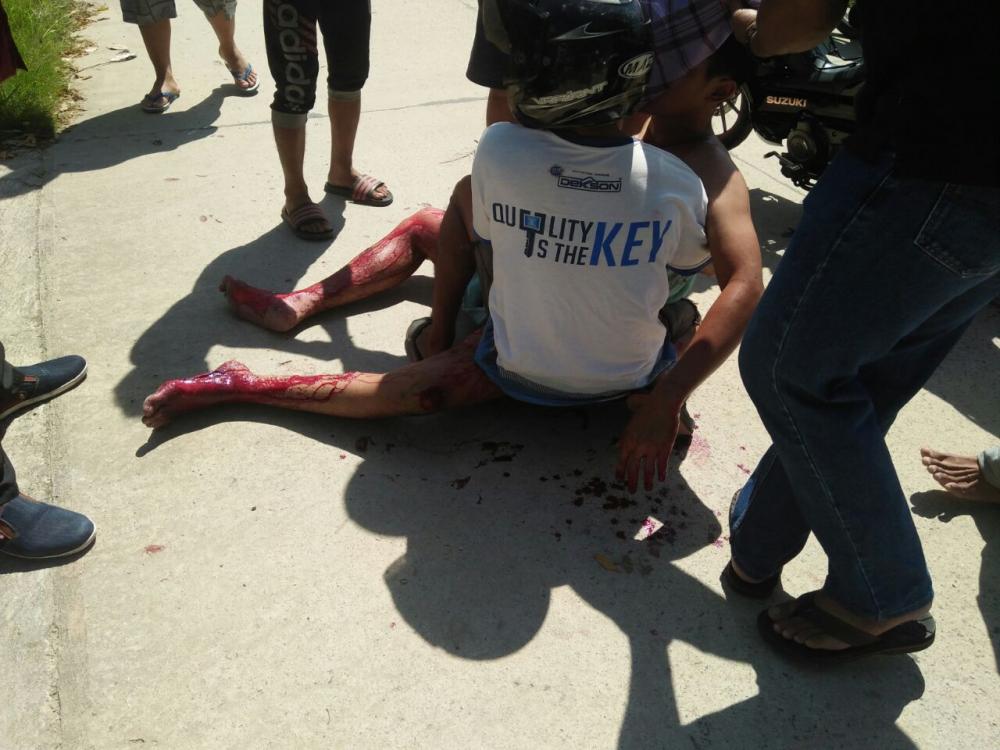 Diduga Depresi, Pemuda Bontang Lari ke Jalan Raya Bersimbah Darah 