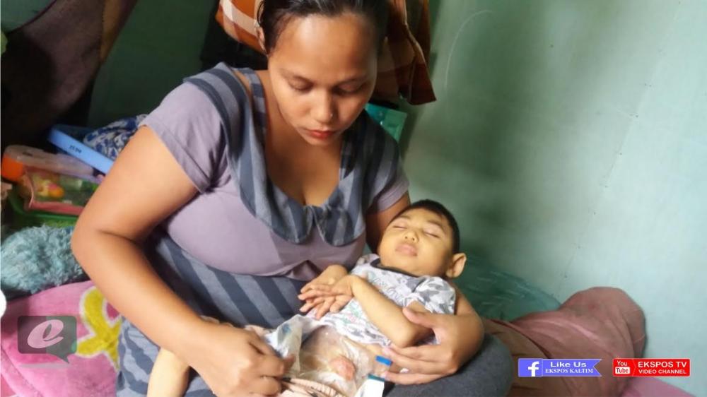 Miris, Anak Usia 3 Tahun Ini Hanya Berbobot 7 Kilogram