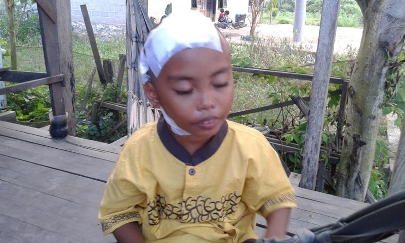 PERJUANGAN SANG AYAH UNTUK KESEMBUHAN SIANAK SULUNG PENDERITA TUMOR