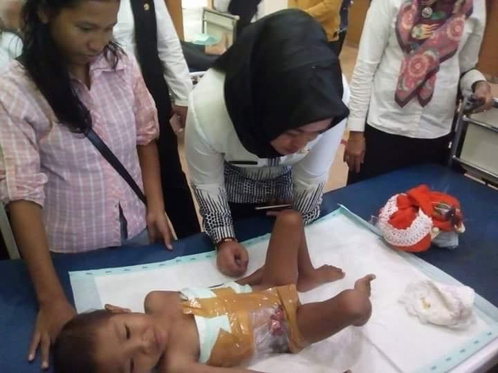 Nurul, Bocah 3 Tahun yang Mengalami Robek di Perut, Sekujur Tubuhnya Dibalut Lakban
