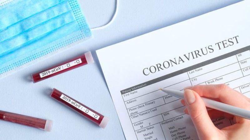 Peneliti China Identifikasi 30 Obat Potensial Tangani Virus Corona
