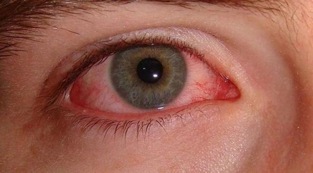 Ini Alasan Penderita Diabetes Harus Cek Kesehatan Mata